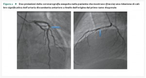 29_2_Caso_6_Fig.2